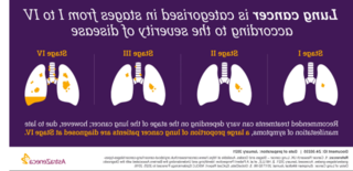 这张动画图表解释了两种主要类型肺癌之间的差异, 以及两种主要形式的肺癌是如何分期的.